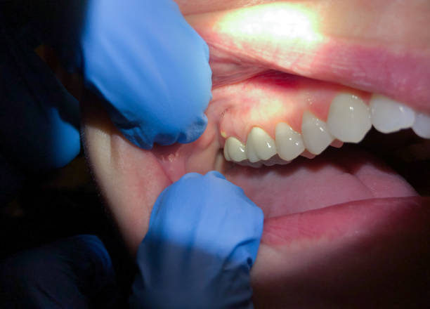 Best Cosmetic Emergency Dentistry in Luckey, OH