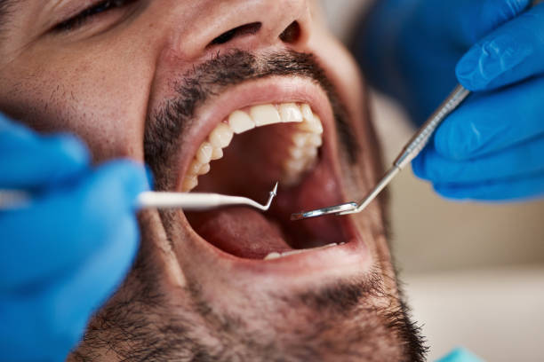 Best Emergency Treatment for Dental Infections or Abscesses in Luckey, OH